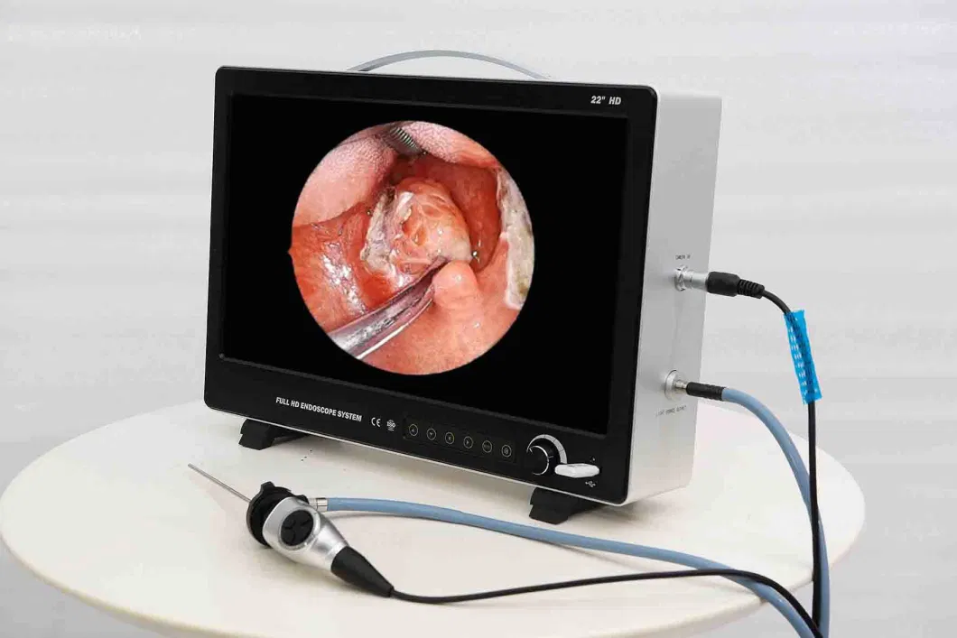 Ltes52 Portable Surgical Endoscopy Camera Medical Endoscope System with Cold Light Source